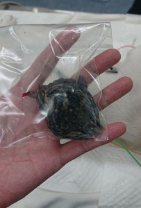 摘出した異物